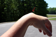 ganglion-cyst-on-wrist.jpg