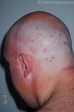 seeing-spots-3.jpg